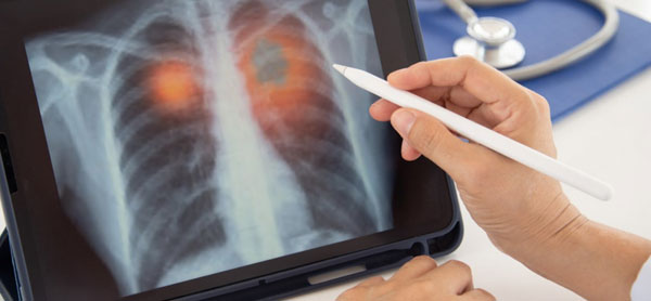 M.Sc Nursing (Nurse Practitioner in critical Care) NPCC